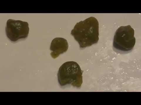 Видео: Очищение печени и ЖКТ в домашних условиях. Это  УЖАС ...что там внутри!