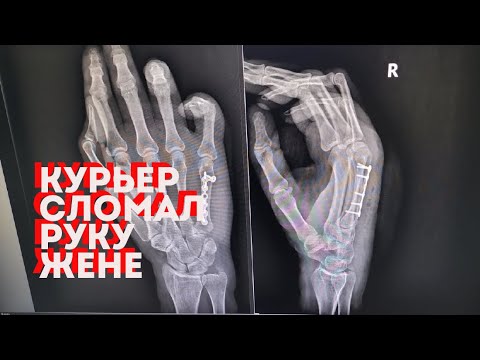 Видео: Курьер сломал руку жене - реакция гайцов