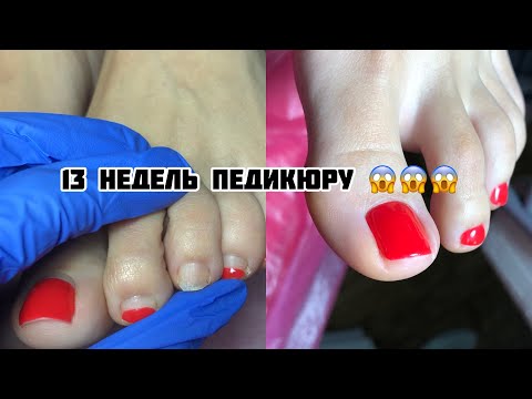Видео: 13 НЕДЕЛЬ ПЕДИКЮРУ! ОБРАБОТКА СТОП ФРЕЗОЙ. ПОЛИРОВКА ПЯТОК