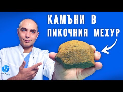 Видео: Камъни в Пикочния Мехур - Как и Защо се Образуват?!