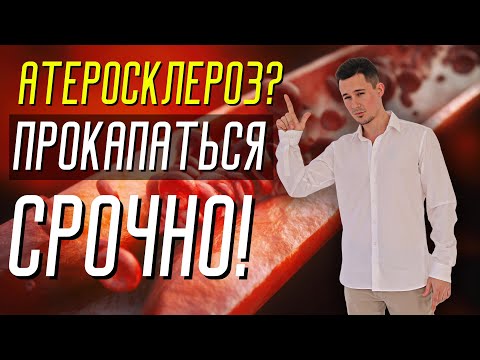 Видео: Инфузионная терапия при облитерирующем атеросклерозе | Тайна