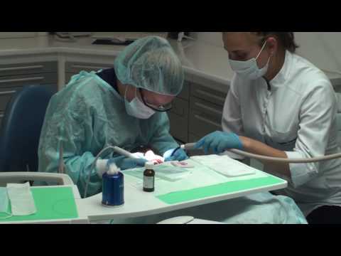 Видео: Профессиональная гигиена полости рта в клинике Hellas Dental