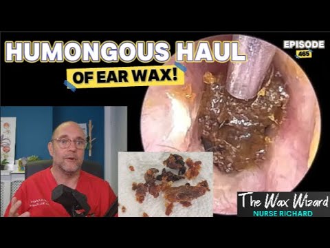 Видео: ОГРОМНЫЙ УЛОВ УШНОЙ СЕРЫ! Эпизод 465 (Это просто шок!)