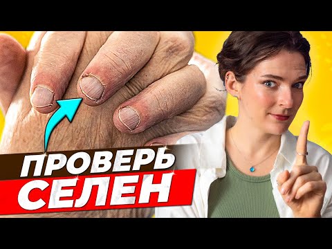 Видео: ✅ ПОЛЬЗА И ❌ ВРЕД СЕЛЕНА || Кому нужен селен, как определить дефицит, селен при гипотиреозе