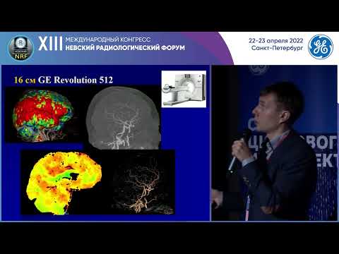 Видео: Супергерои в борьбе с ОНМК: новые тарифы, новые тарифы, новые возможности