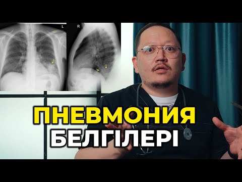 Видео: Өкпе ауруы! Ең соңғы қауіпті асқыну! Пневмония! Өкпе ауруының белгілері