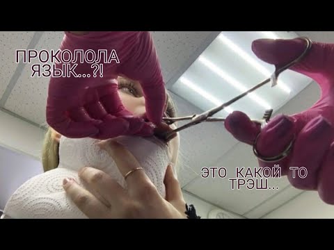 Видео: ПРОКОЛ ЯЗЫКА. МОЯ НЕДЕЛЯ.