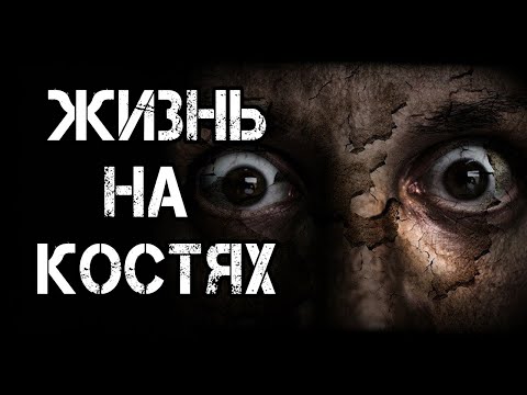 Видео: Страшные истории на ночь | ЖИЗНЬ НА КОСТЯХ | Страшилки