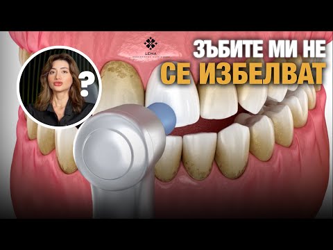 Видео: 🤍 Я чищу зубы, но они не отбеливаются? — Стоматологическая клиника Lema