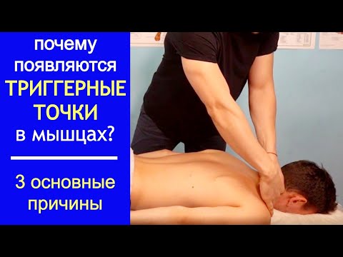 Видео: Триггерные точки. 3 основные причины появления триггеров в мышцах