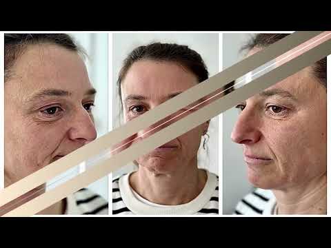 Видео: МОЕТО НОВО АЗ Епизод 7 Bellissimo Clinic - Историята на Катерина