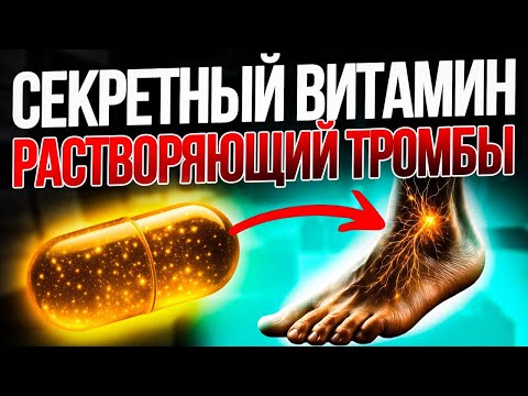 Видео: БАБУШКИ ЗНАЛИ О НЕМ..  ВИТАМИН №1 от варикоза!  РАСТВОРЯЕТ ТРОМБЫ!