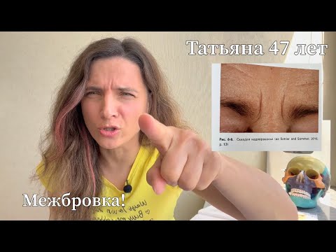 Видео: Убираем межбровную морщину