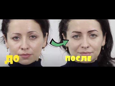 Видео: Напыление Бровей при ярковыраженном птозе.