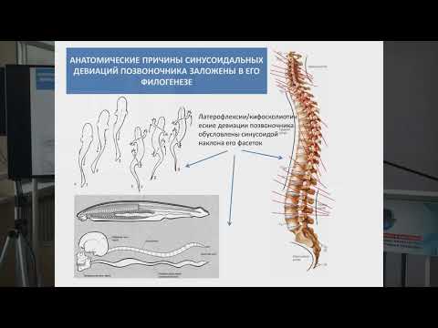 Видео: Маркеры дисплазии соединительной ткани: синдром «короткой» ноги и синдром гипермобильности