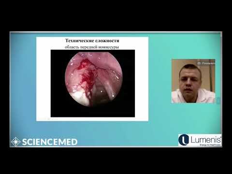 Видео: "Функционально щадящие методы лечения рака голосового отдела гортани" - Решульский С.С