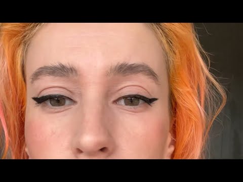 Видео: TSW Topical steroid withdrawal- Синдром отмены кортикостероидов 1год и 9 месяцев спустя 