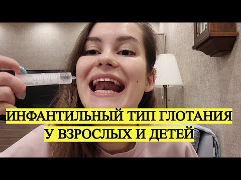 Видео: Инфантильный тип глотания! Как глотать правильно?