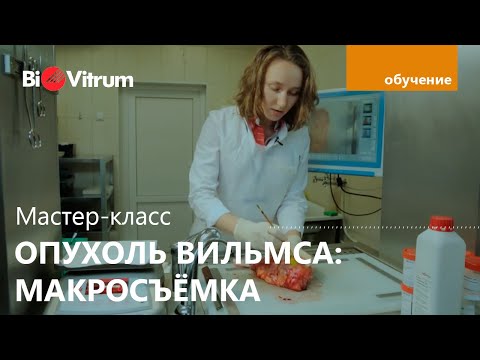 Видео: Макросъемка нефробластомы