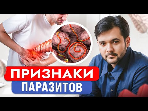 Видео: Этот СПОСОБ 100% Убьет Всех Паразитов в Вашем Организме!