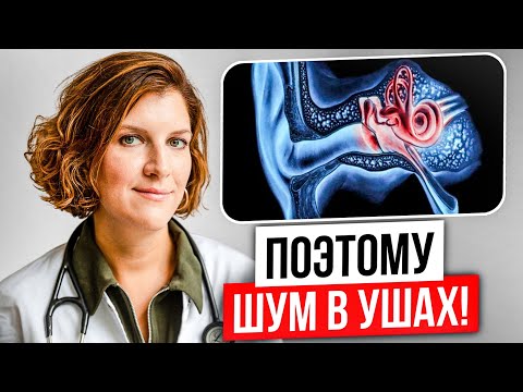 Видео: 92% людей НЕ ЗНАЮТ почему появляется ШУМ в Ушах! Как лечить БЕЗ ТАБЛЕТОК?