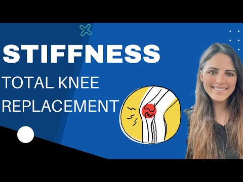 Видео: Скованность после тотального эндопротезирования коленного сустава: нормально ли это?