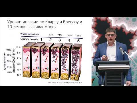 Видео: Беспигментная (амеланотическая) меланома: диагностика и принципы хирургического лечения