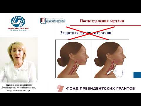 Видео: Функциональные нарушения у больных раком гортани и гортаноглотки после полного удаления гортани.