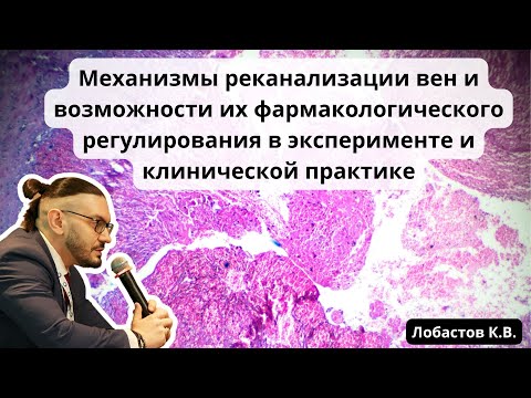 Видео: Видеолекция "Механизмы реканализации вен и возможности их фармакологического регулирования"