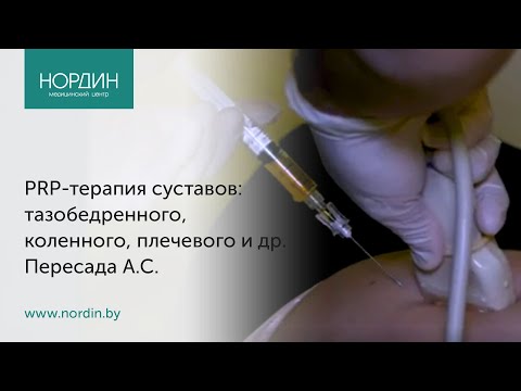 Видео: PRP-терапия суставов: коленного, тазобедренного, плечевого. Кому рекомендована, как выполняется