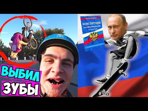 Видео: СЛОМАЛ ЗУБЫ на BMX