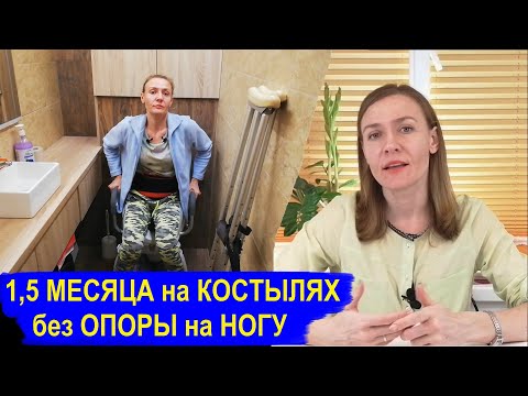Видео: 1,5 месяца на костылях без опоры на ногу: моё состояние, решающий снимок после Остеотомии