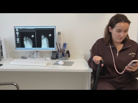 Видео: МОЙ ПЕРЕЛОМ НЕЛЬЗЯ ГИПСОВАТЬ. 14.11.25.