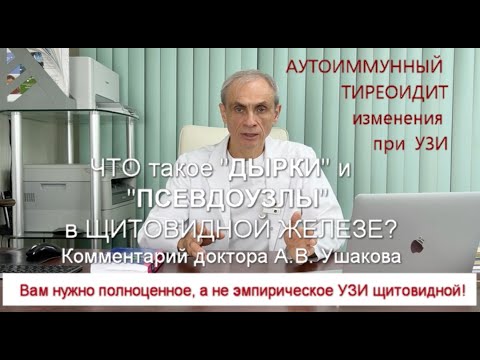 Видео: Что такое "Дырки", "Псевдо-Узлы", "Жираф" в Щитовидной при Аутоиммунном Тиреоидите? // Доктор Ушаков