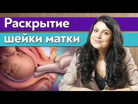 Видео: Шейка матки / Как ускорить раскрытие шейки матки при родах?