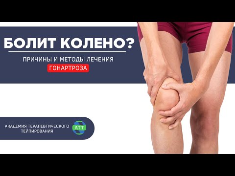 Видео: Гонартроз I Тейпирование коленного сустава