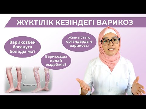 Видео: Жүктілік кезіндегі варикоз/Варикоз болса табиғи жолмен босануға болады ма?