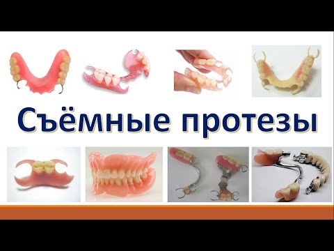 Видео: Секреты Стоматологии - Глава 5. Съёмные протезы