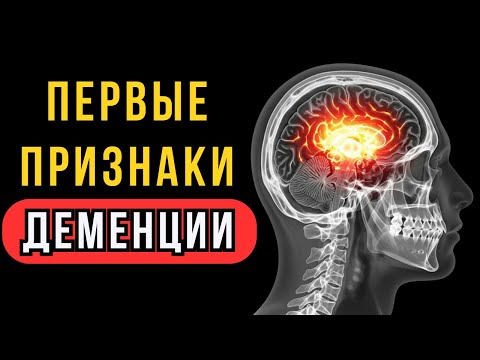 Видео: ДЕМЕНЦИЯ началась, если человек говорит ЭТУ ФРАЗУ! Распознай ранние признаки деменции