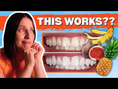 Видео: Можно ли отбелить зубы естественным путем? | Ответы на ваши стоматологические вопросы