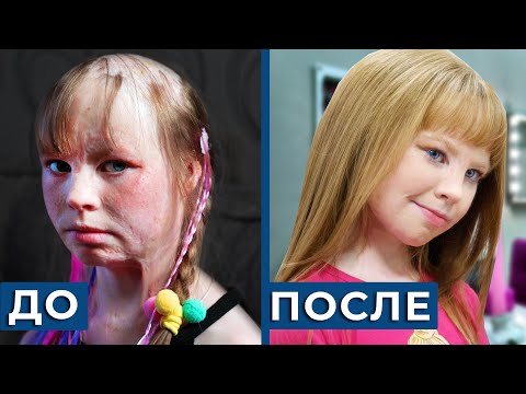 Видео: 🔥 После ПОЖАРА в КРАСАВИЦУ, преображение ДО и ПОСЛЕ / новая жизнь Алеси