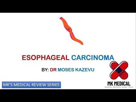 Видео: Карцинома пищевода