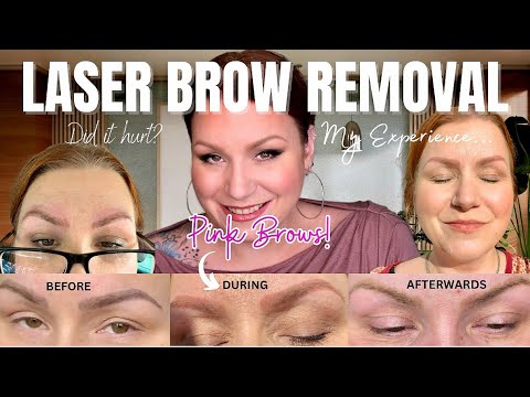 Видео: Мне удалили микроблейдинг бровей лазером. Вот что вам никто не расскажет