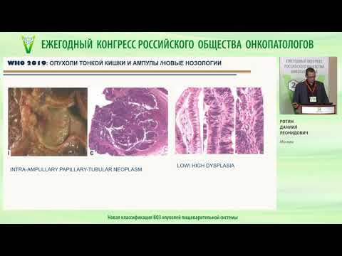 Видео: Новая классификация ВОЗ опухолей пищеварительной системы
