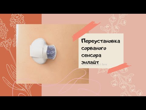 Видео: Переустановка сенсора Энлайт (Enlite) Медтроник