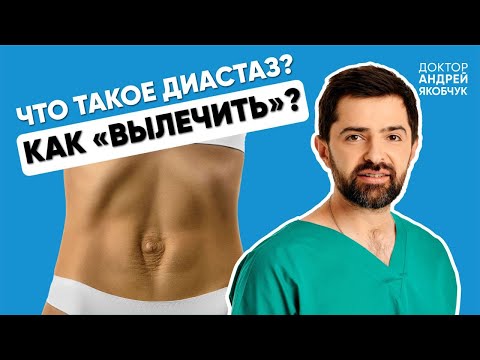 Видео: Что такое диастаз, как убрать диастаз, пресс и диастаз, опасность диастаза: доктор Андрей Якобчук