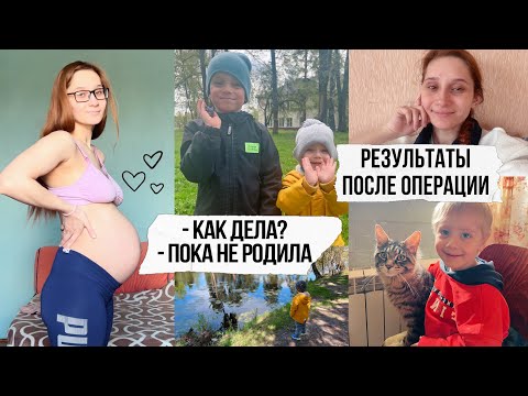 Видео: 39 недель беременности 🤰🏻Когда роды?