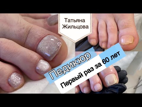 Видео: Первый раз в жизни 🧐 / Возрастной педикюр / Изменение ногтевой пластины