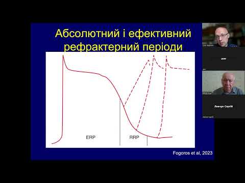 Видео: Методи обстеження пацієнтів з аритміями і блокадами серця