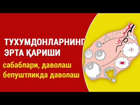 Видео: Тухумдонларни эрта қариши. Сабаблари, даволаш ва бепуштликни даволаш.